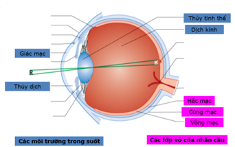 Bệnh lý gây mù ở trẻ em