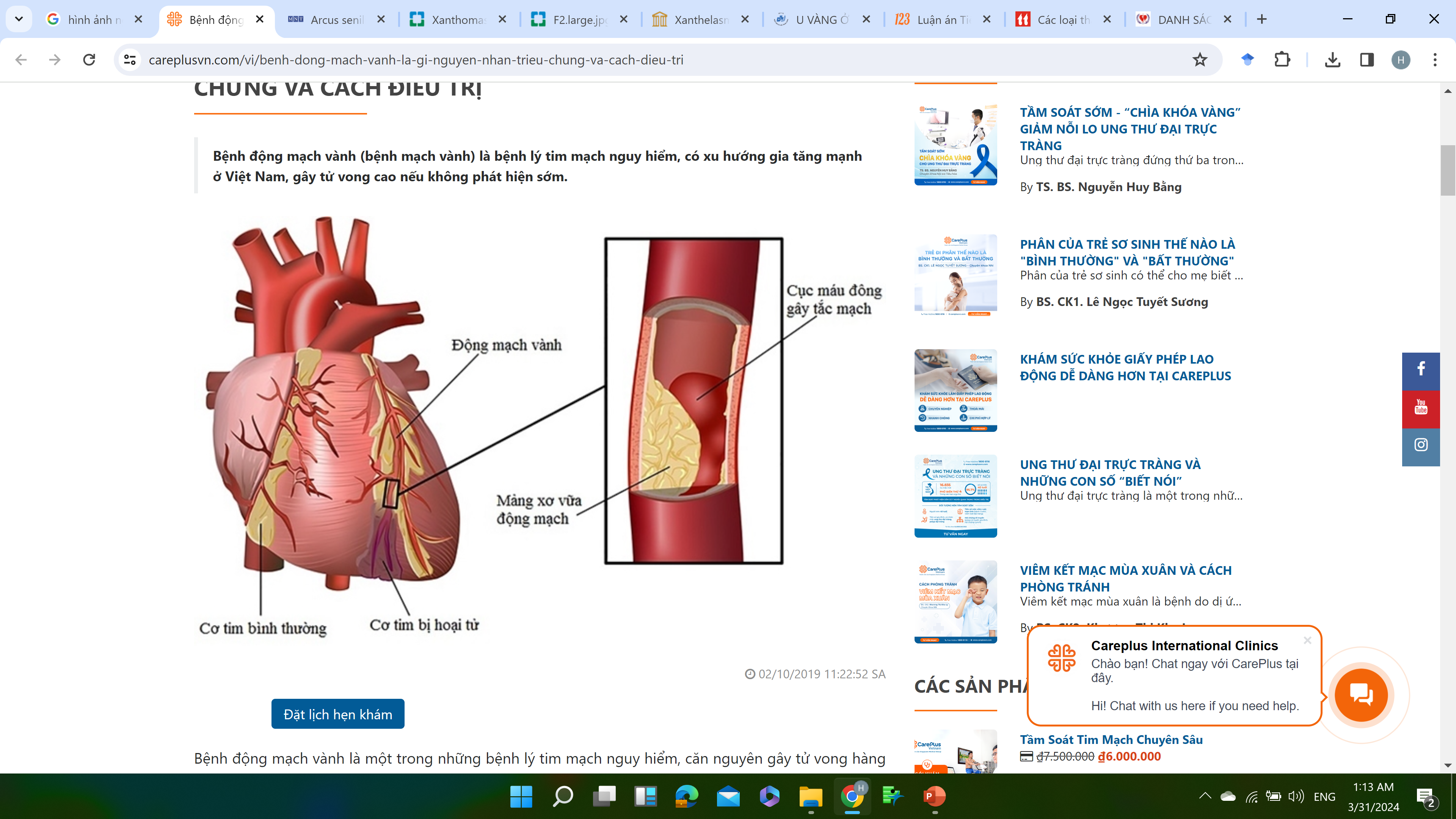 RỐI LOẠN LIPID MÁU-BỆNH TIM MẠCH XƠ VỮA