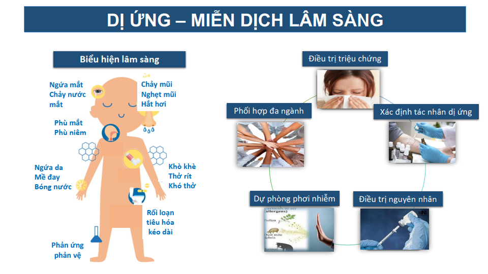 4. Cách chẩn đoán dị ứng