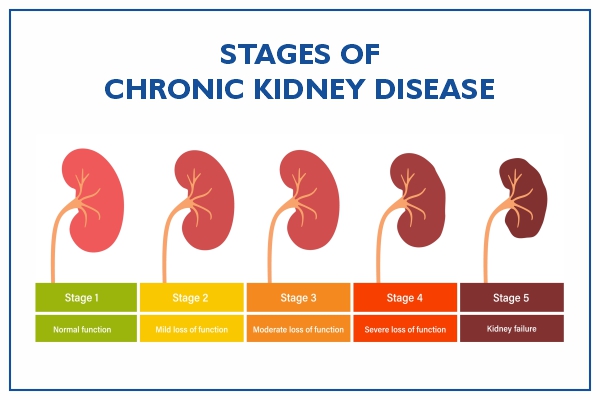 Chronic Kidney Disease: Symptoms, Causes, Diagnosis, Treatment, Prevention  | Medicover