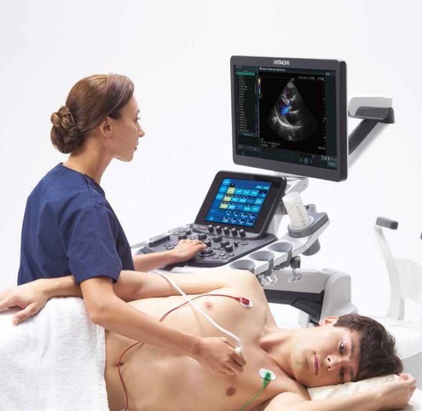 Ý nghĩa các chỉ số siêu âm tim